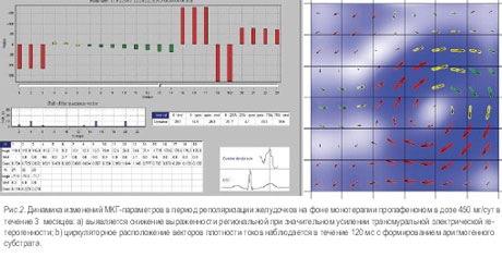 ��������

��������� ���-���������� � ������ ������������� ���������� �� ���� ����������� ������������ � ���� 450 ��/��� � ������� 3 �������: a) ���������� �������� ������������ ������������ ��� ������������ �������� �������������� ������������� ��-



������������; b) ������������� ������������ �������� ��������� ����� ����������� � ������� 120 �� � ������������� �������������
���������
