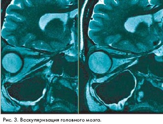 ����� ����������� ��������-����������� �����������