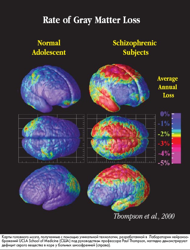 ��������-����������� ������������ ��� ������ ����������� ����������