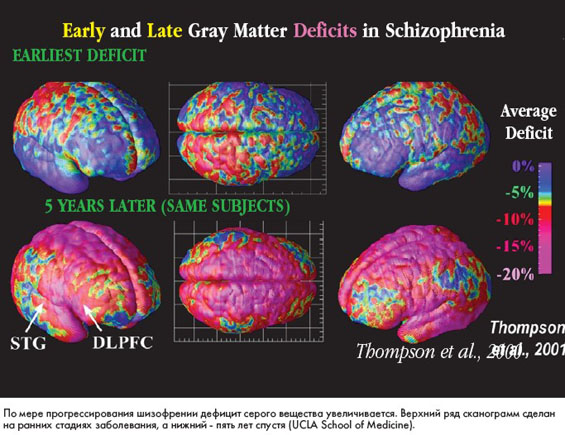 ��������-����������� ������������ ��� ������ ����������� ����������