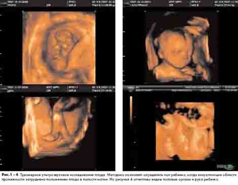 ������ ��������� �������������� �����������