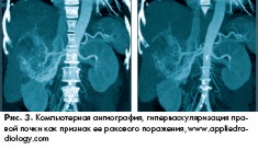 ����� ��������� ������������������� �����������