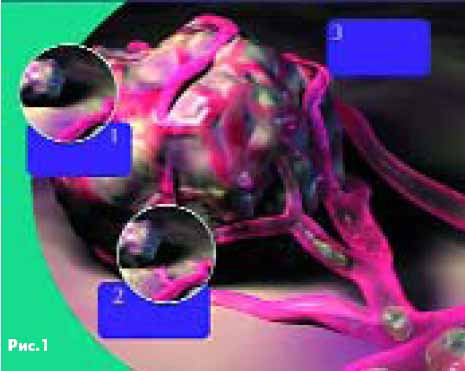 ����� ����������� � ������� ����