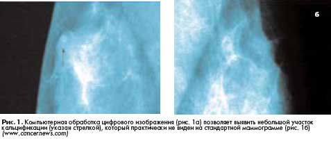 ����� � ����������� �������� �������� ������