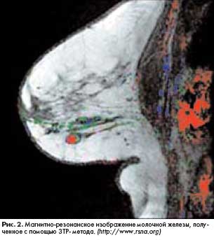 ����� � ����������� �������� �������� ������