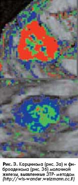 ����� � ����������� �������� �������� ������