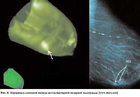 ����� � ����������� �������� �������� ������