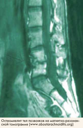 ��� ��� ����������� �����������-�������������� ���������