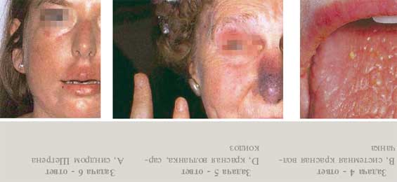 ���������� ����������� �� ������� ��������