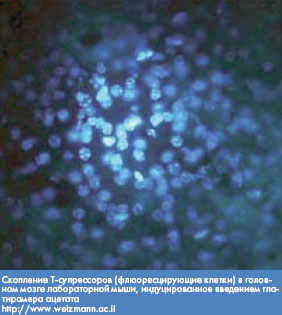 Эффективное лечение рассеянного склероза