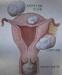 ����� �����, �������